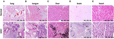 Case Report: Coexistence of generalized arterial calcification of infancy (GACI) and maternal infections with cytomegalovirus and Toxoplasma gondii-unexpected fatal complication in a newborn